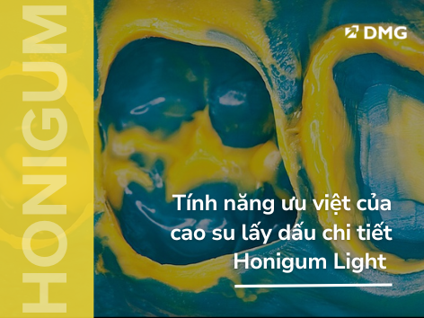 Tính năng ưu việt của cao su lấy dấu chi tiết - Honigum Light