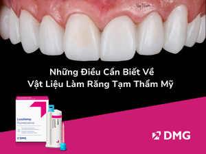 Luxatemp - Những Điều Cần Biết Về Vật Liệu Làm Răng Tạm Thẩm Mỹ