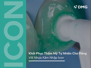 Khôi Phục Thẩm Mỹ Tự Nhiên Cho Răng Với Nhựa Xâm Nhập Icon