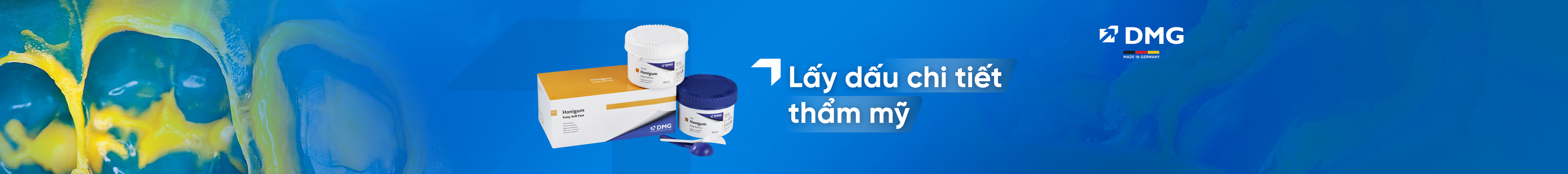 Vật liệu lấy dấu