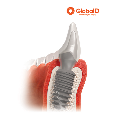 In-Kone® Universal Implant