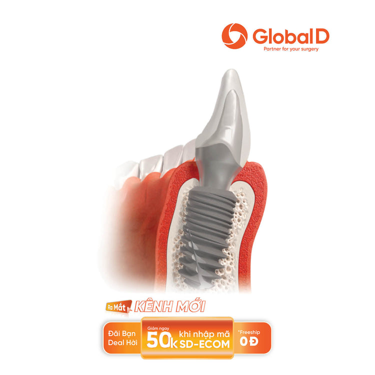 In-Kone® Universal Implant